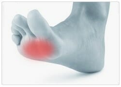 What is Metatarsalgia Foot Pain or Inflammation