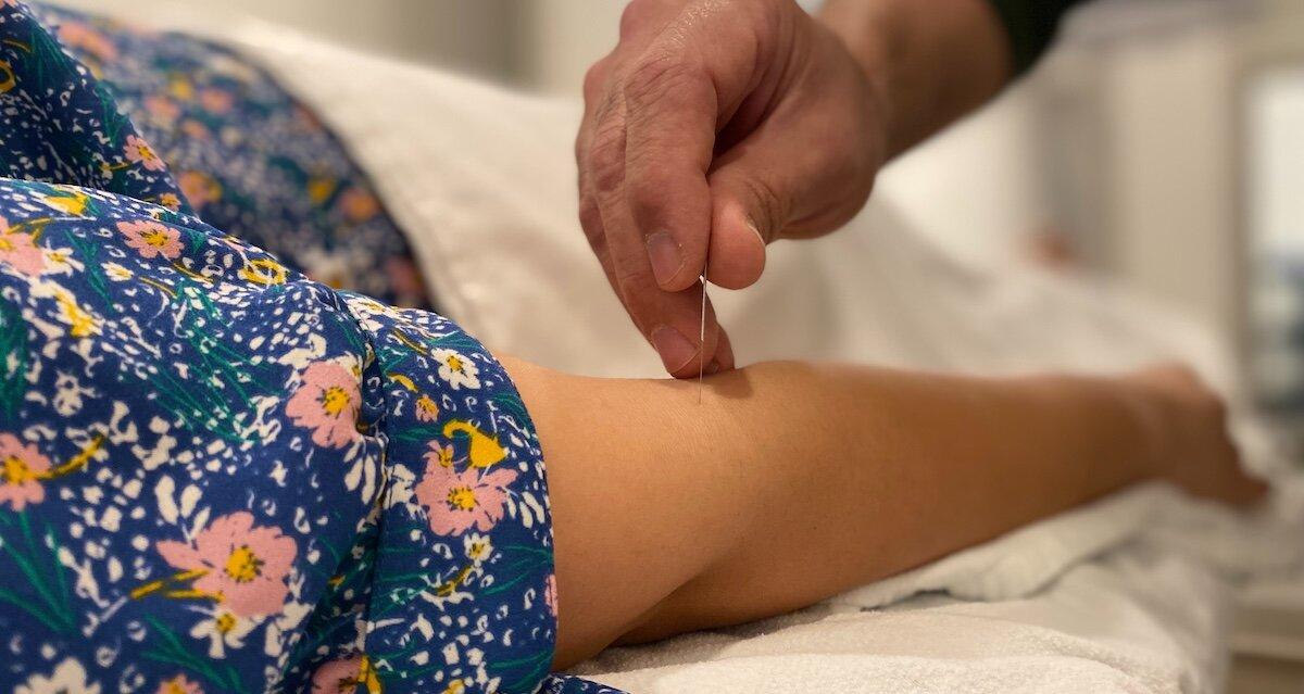 Can Physiotherapists Do Acupuncture Burnaby BC